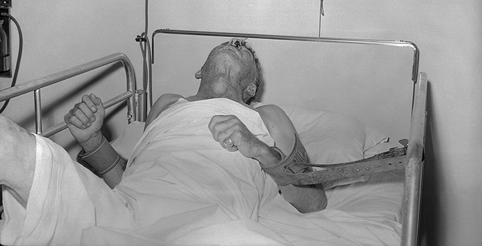 rabies patient 1959